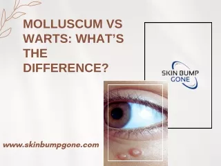 Molluscum vs warts What’s The Difference