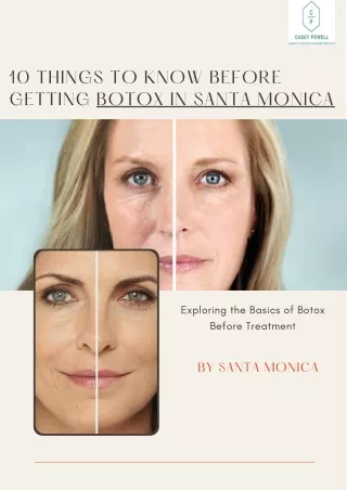 10 Things to Know Before Getting the Botox Santa Monica