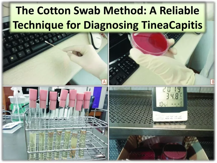 the cotton swab method a reliable technique for diagnosing tineacapitis