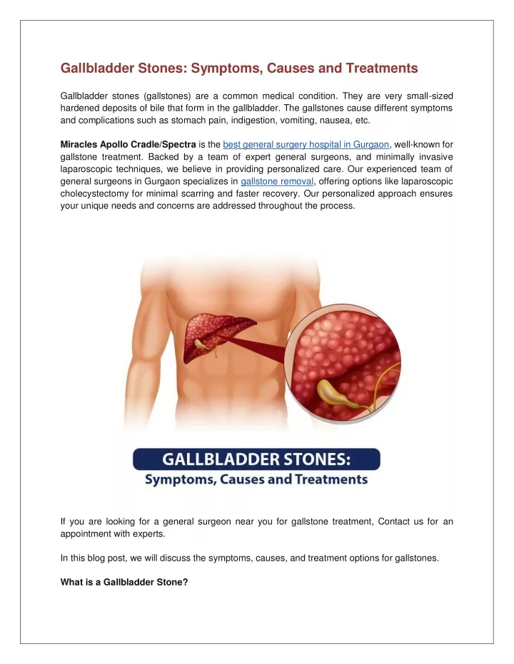 gallbladder stones symptoms causes and treatments