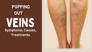 How to Reduce Veins Popping Out: Effective Remedies