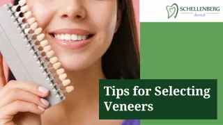 Tips for Selecting Veneers