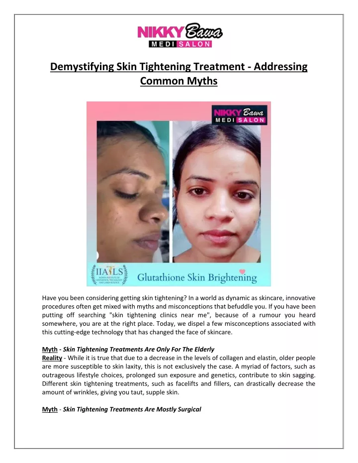 demystifying skin tightening treatment addressing