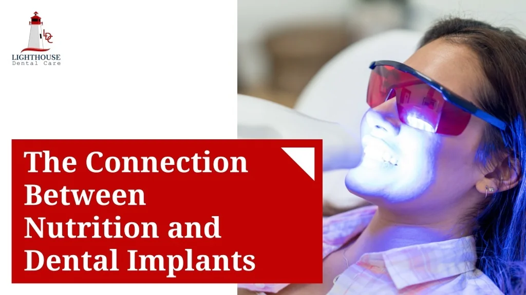 PPT - The Connection Between Nutrition And Dental Implants PowerPoint ...