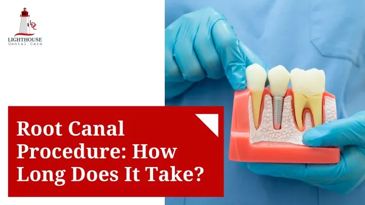 root canal procedure how long does it take