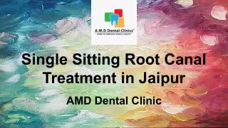 Single Sitting Root Canal Treatment in Jaipur