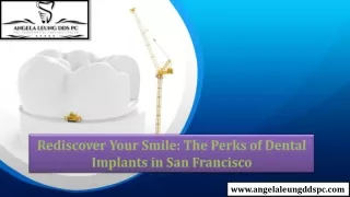 Rediscover Your Smile The Perks of Dental Implants in San Francisco