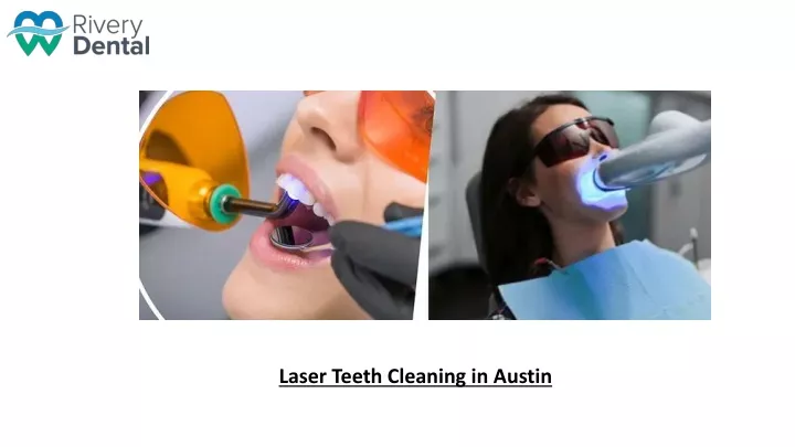 laser teeth cleaning in austin