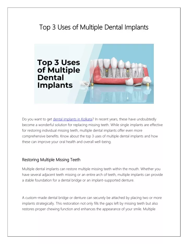 top 3 uses of multiple dental implants top 3 uses