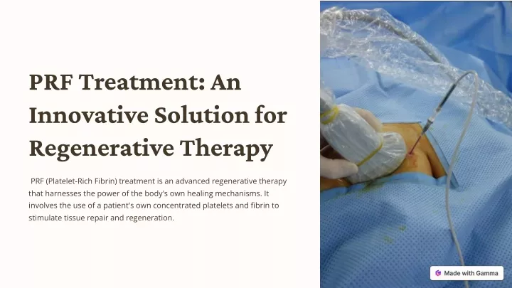 prf treatment an innovative solution