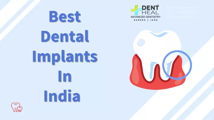 best dental implants in india