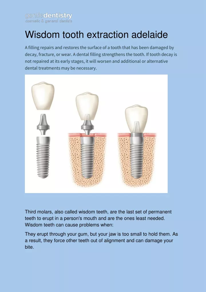 wisdom tooth extraction adelaide