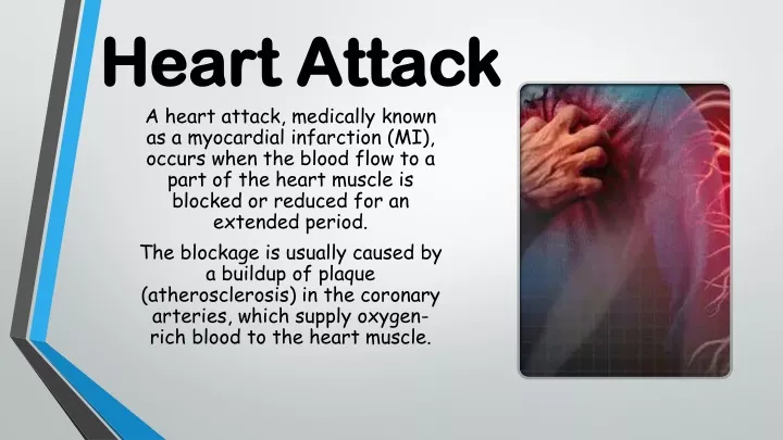 heart attack