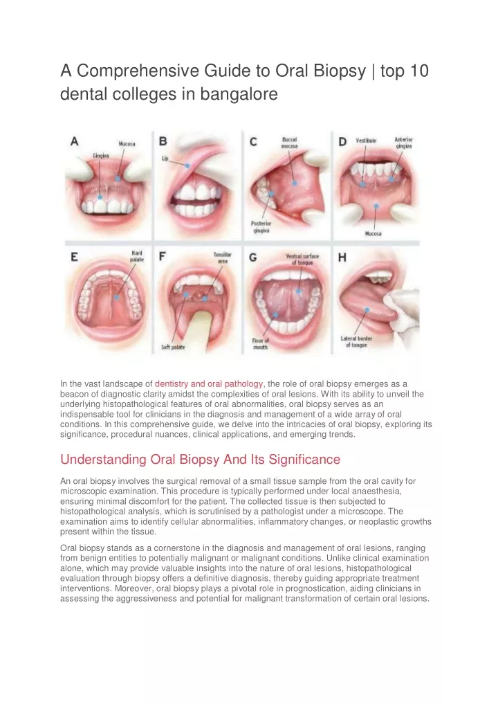 a comprehensive guide to oral biopsy
