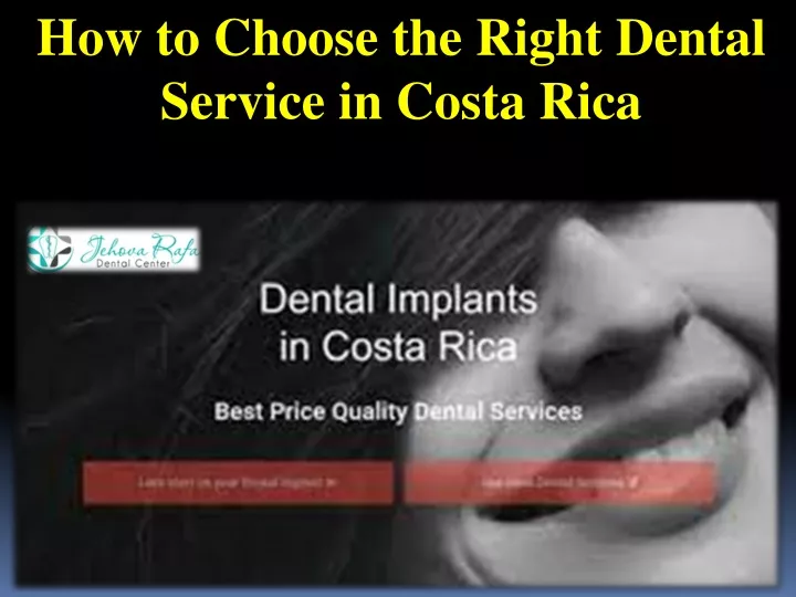 how to choose the right dental service in costa