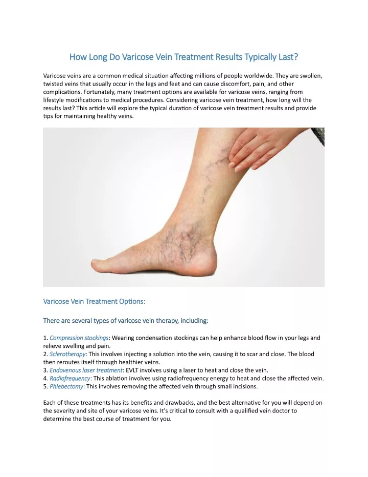 how long do varicose vein treatment results