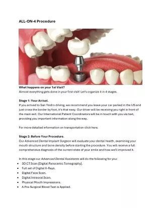 Transform Your Smile with the All-On-4 Dental Implant Procedure