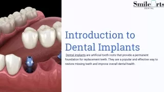 introduction to dental implants dental implants