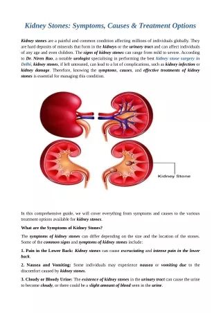 Kidney Stones: Symptoms, Causes & Treatment Options