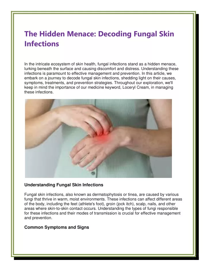 the hidden menace decoding fungal skin infections