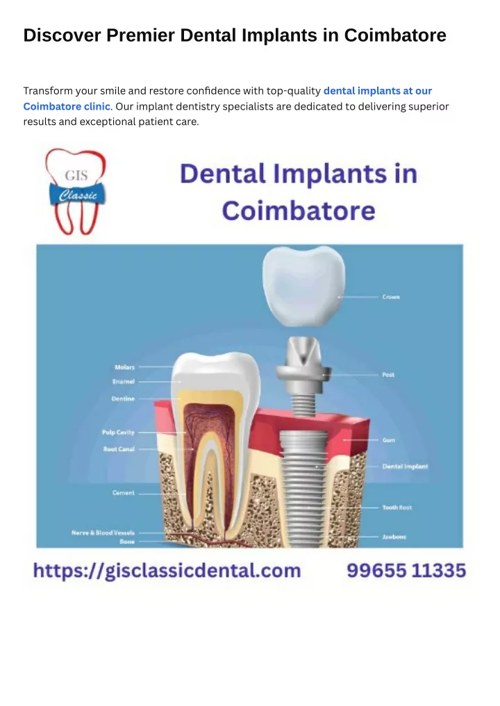 discover premier dental implants in coimbatore