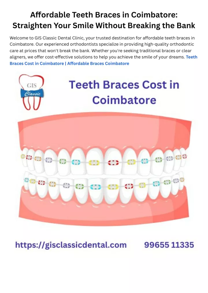 a ordable teeth braces in coimbatore straighten