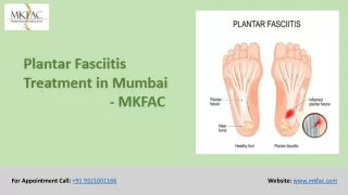 Plantar Fasciitis Treatment in Mumbai | MKFAC
