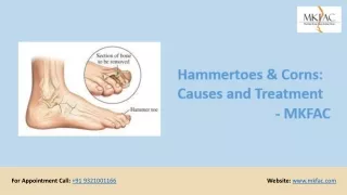 Hammertoes & Corns Causes and Treatment | MKFAC