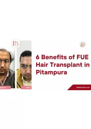 6 Benefits of FUE Hair Transplant in Pitampura