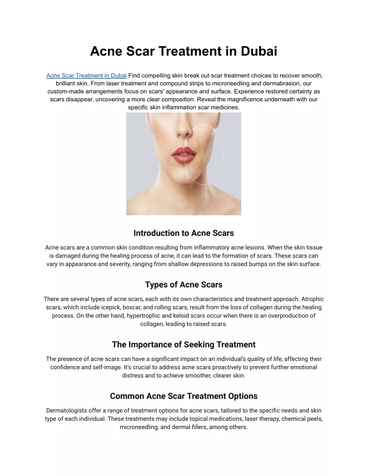 acne scar treatment in dubai
