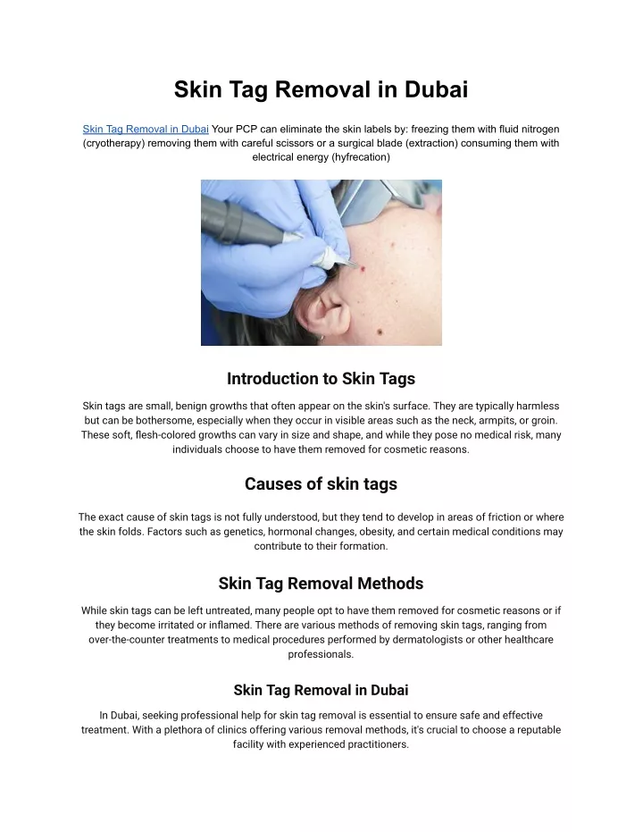 skin tag removal in dubai