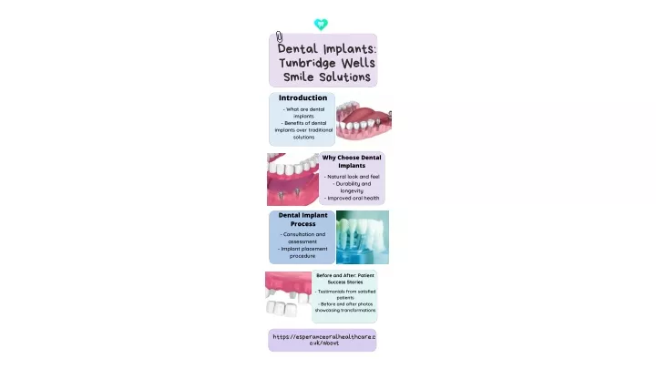 dental implants dental implants tunbridge wells