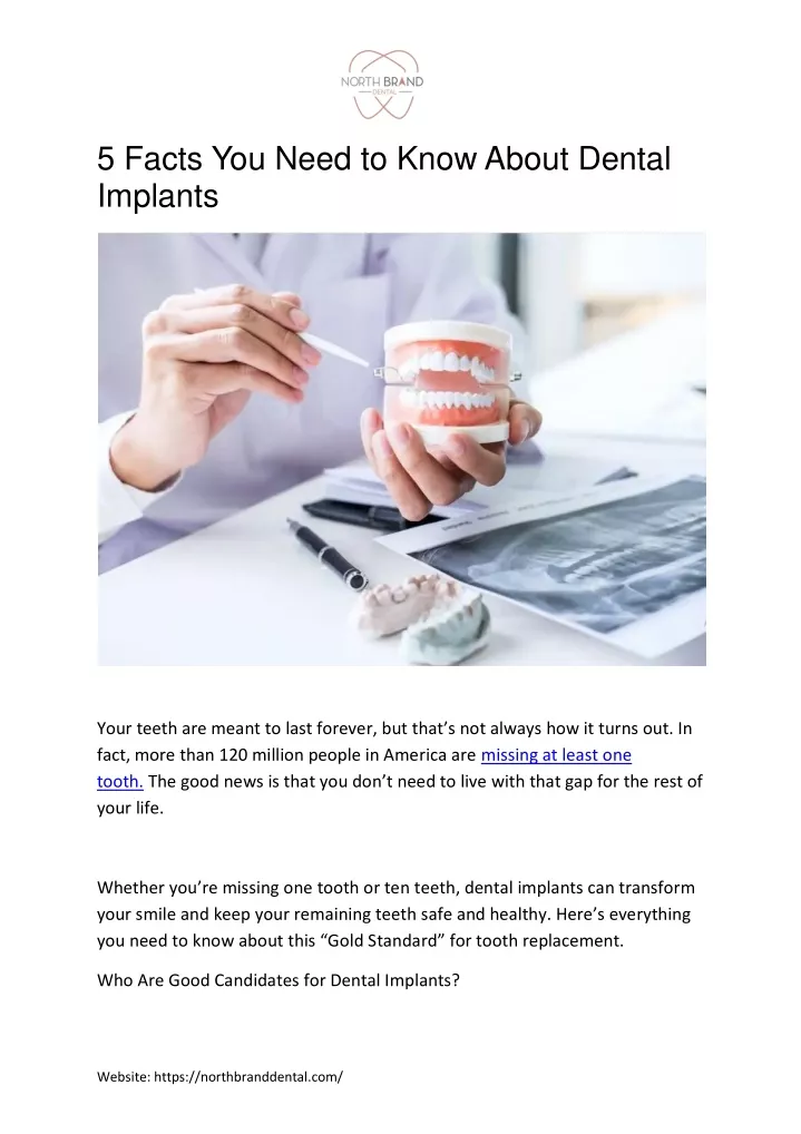 5 facts you need to know about dental implants