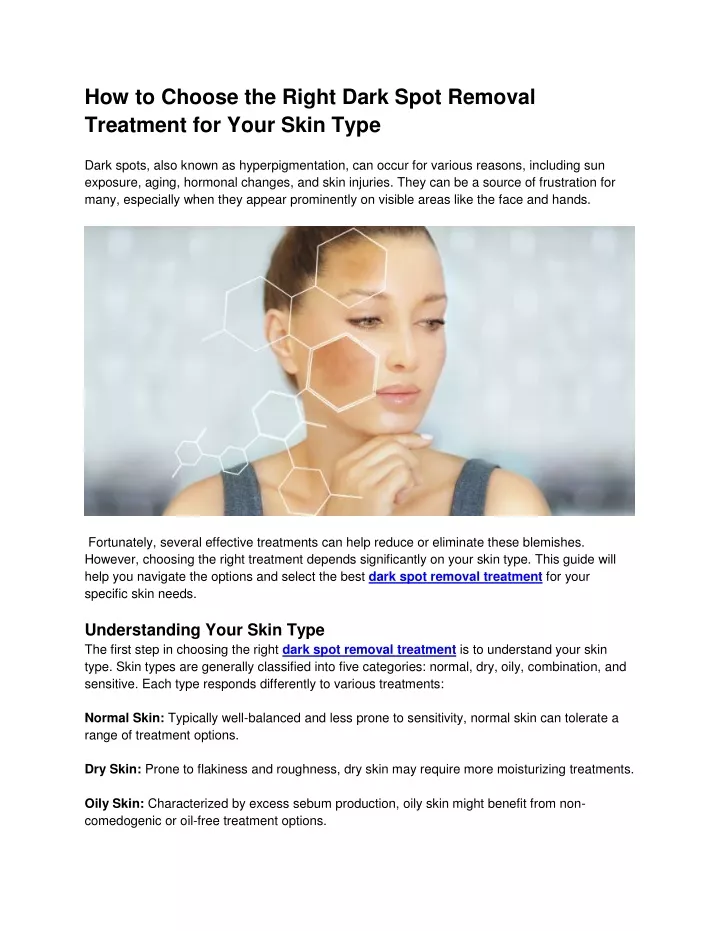 how to choose the right dark spot removal