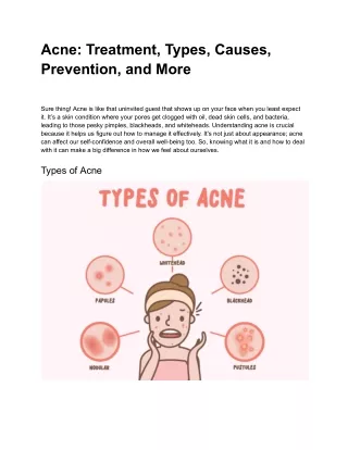 Acne: Treatment, Types, Causes, Prevention, and More