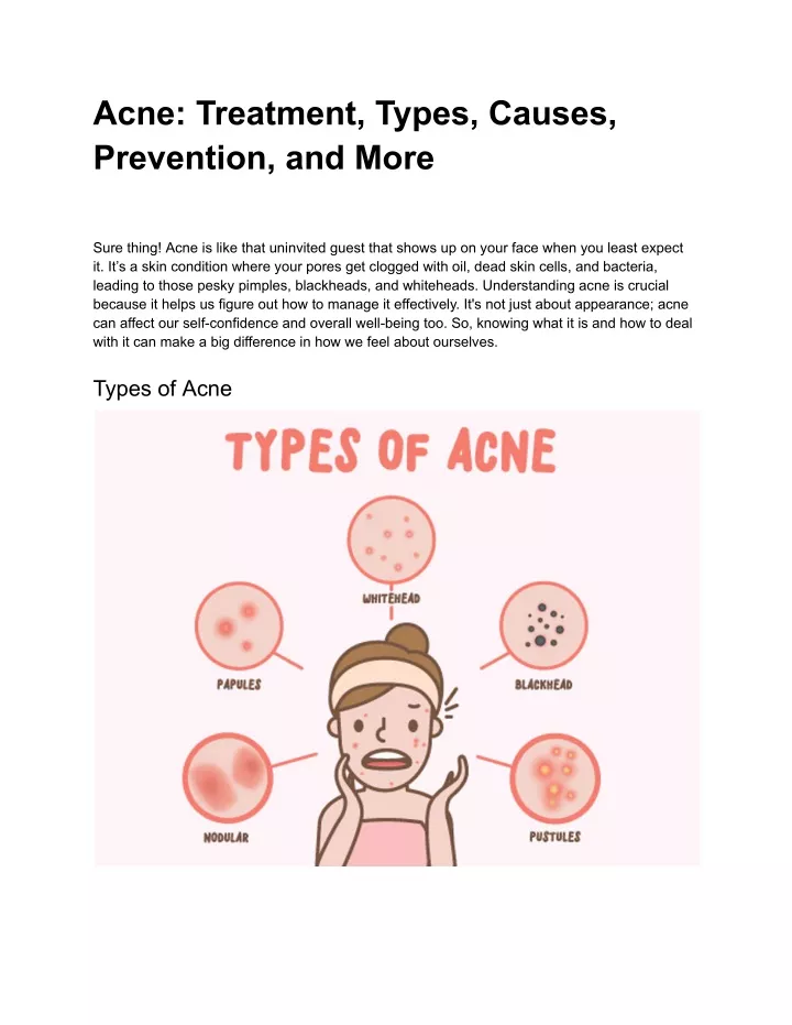 acne treatment types causes prevention and more