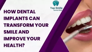 How Dental Implants Can Transform Your Smile and Improve Your Health?