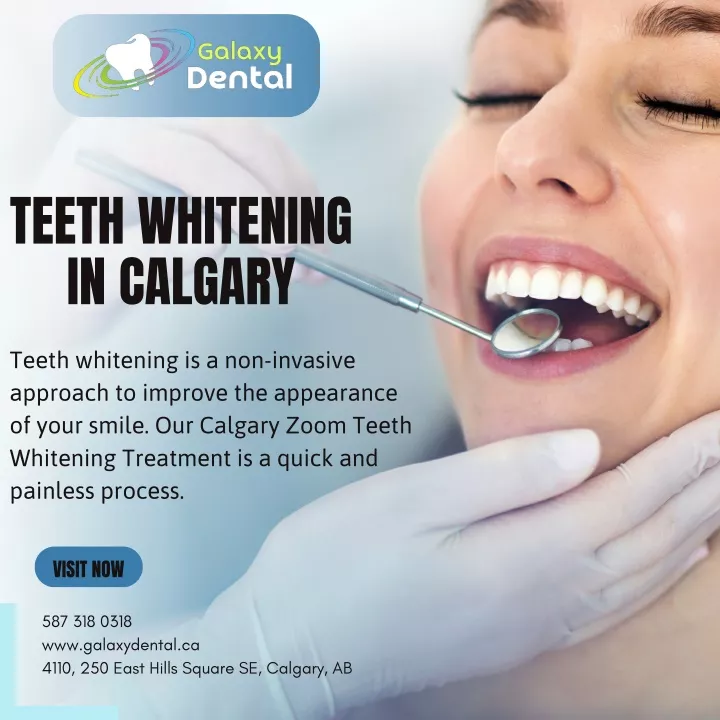 teeth whitening in calgary