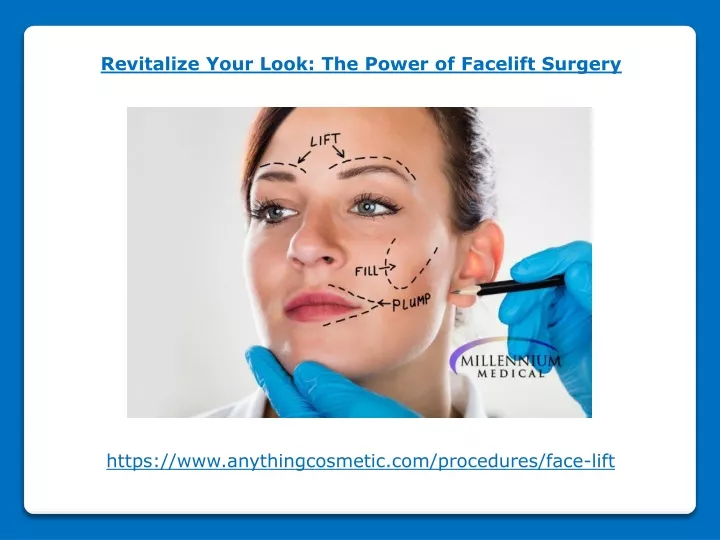 revitalize your look the power of facelift surgery
