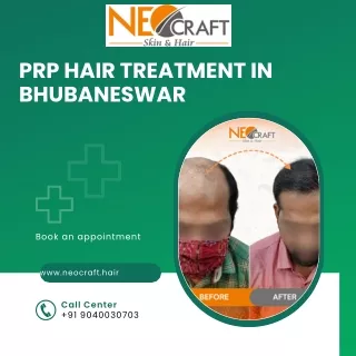 PRP Hair Treatment Clinic in Bhubaneswar