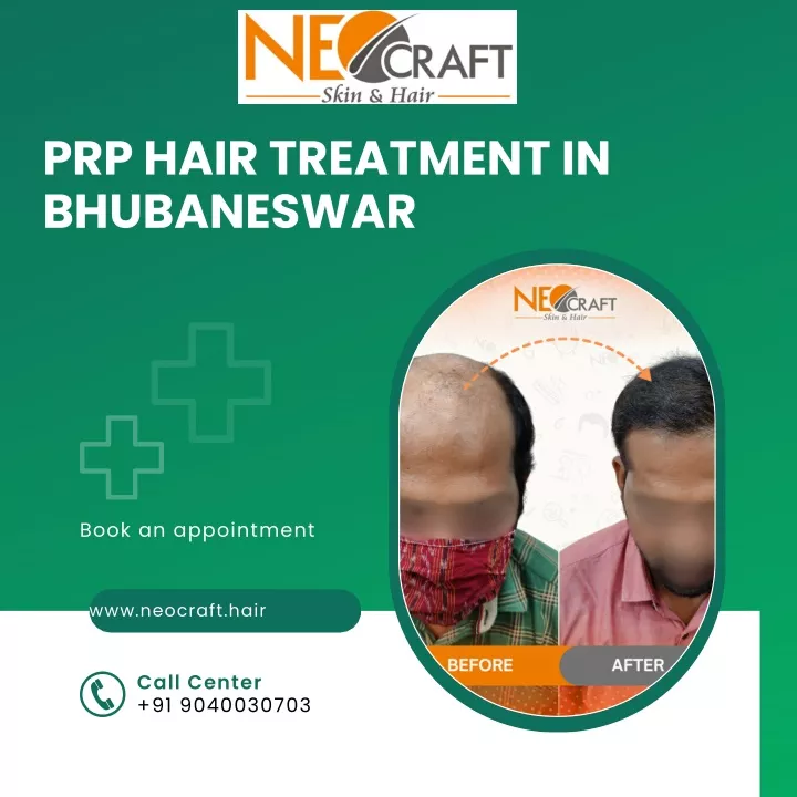 Ppt Prp Hair Treatment Clinic In Bhubaneswar Powerpoint Presentation Id 13221158