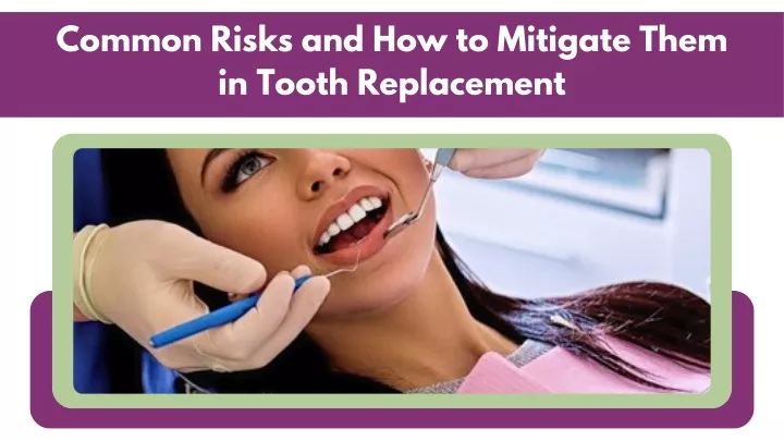 common risks and how to mitigate them in tooth