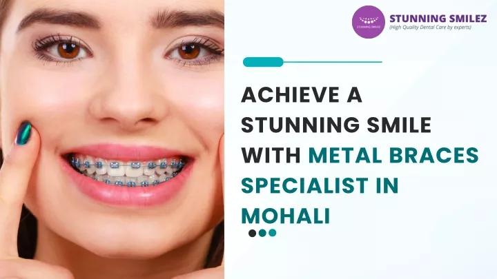 achieve a stunning smile with metal braces