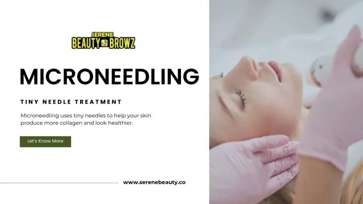 microneedling