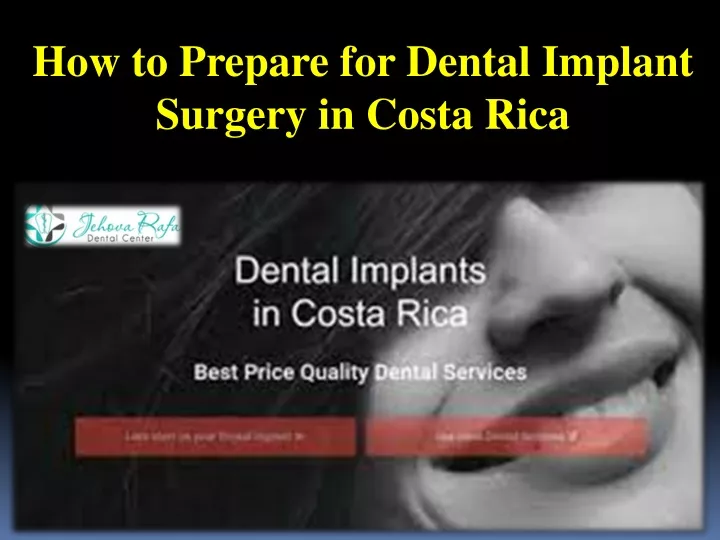 how to prepare for dental implant surgery