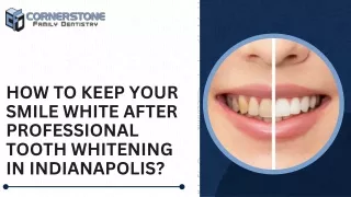 How to Keep Your Smile White After Professional Tooth Whitening in Indianapolis