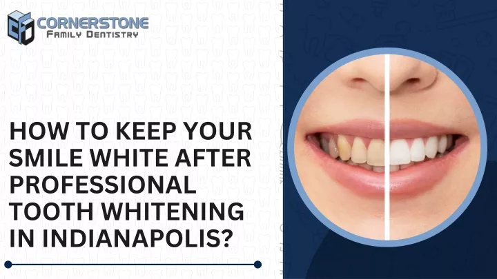 how to keep your smile white after professional