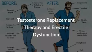 Testosterone Replacement Therapy & ED