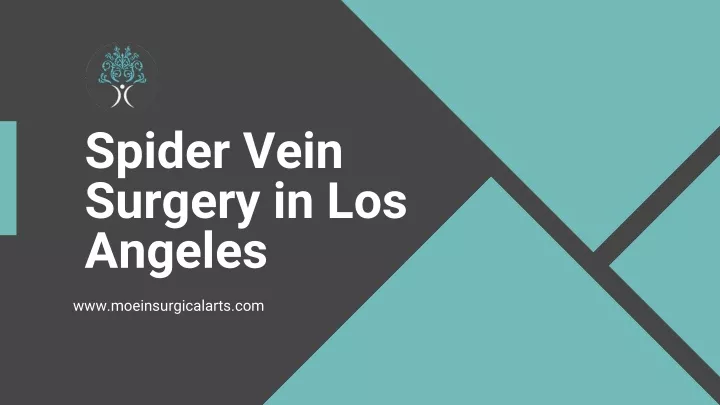 spider vein surgery in los angeles