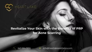 Revitalize Your Skin with the Benefits of PRP for Acne Scarring